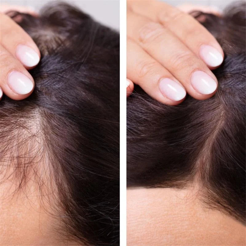 10Bottle Ginger Hair Growth Product Anti Hair Loss