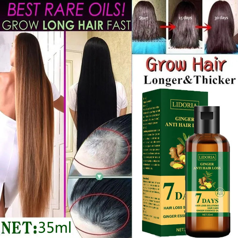 10Bottle Ginger Hair Growth Product Anti Hair Loss