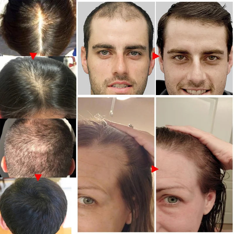10Bottle Ginger Hair Growth Product Anti Hair Loss
