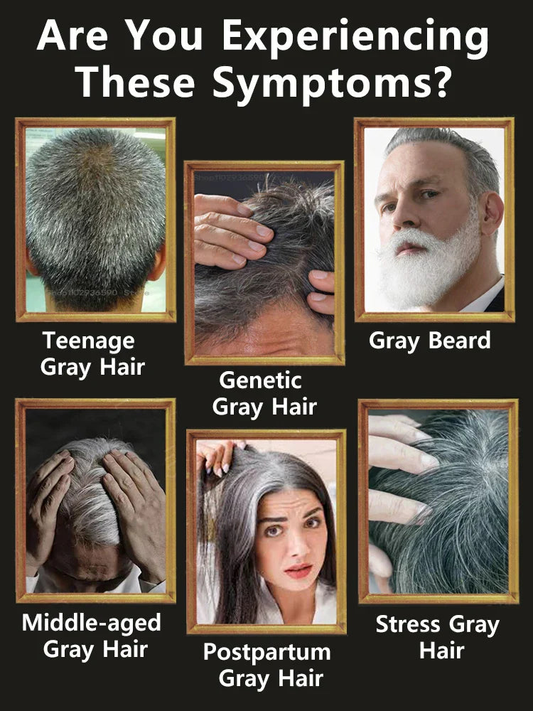 10PCS Gray White Hair Treatment Serum Liquid White