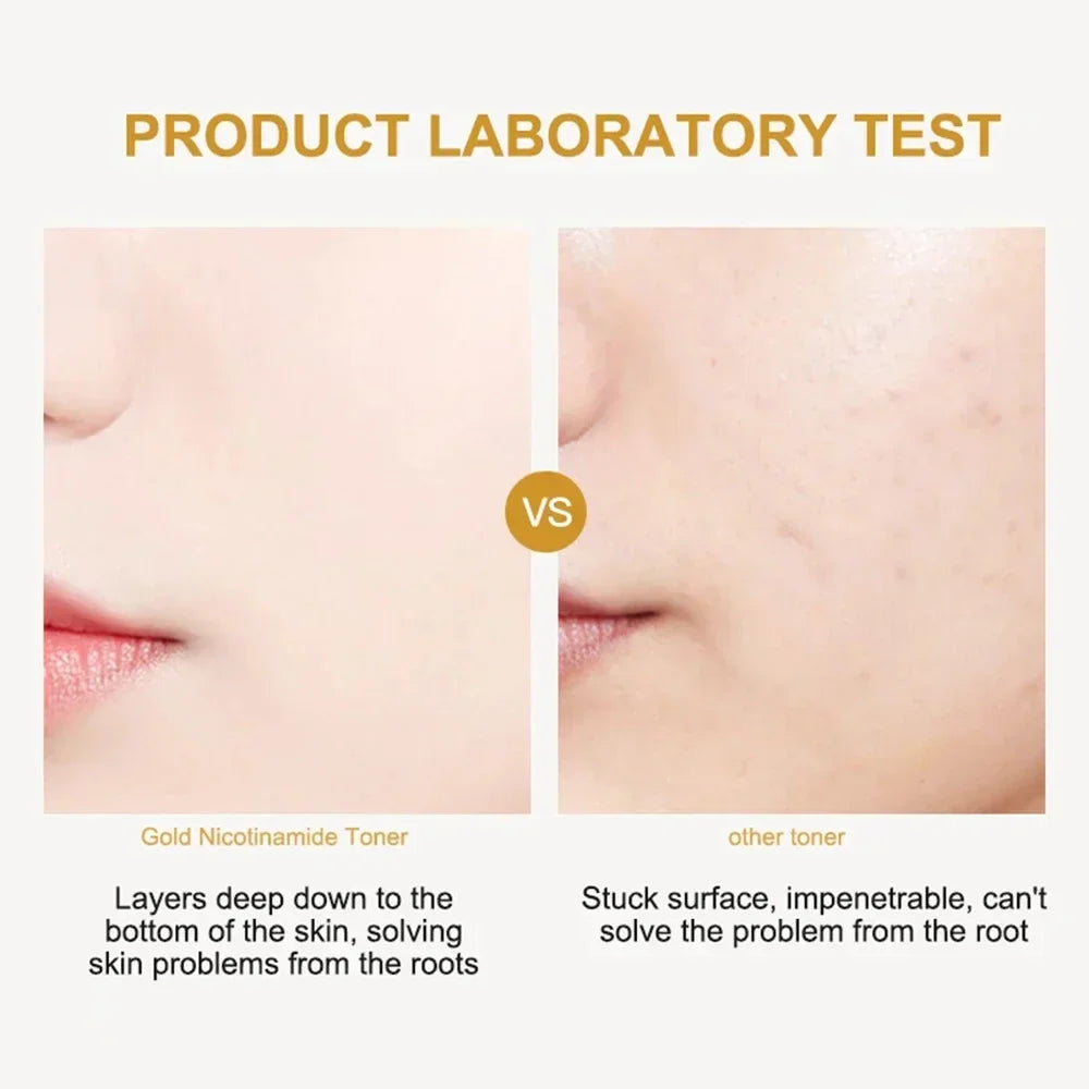 300ml Face 24K Gold Nicotinamide Toner Moisturize Oil