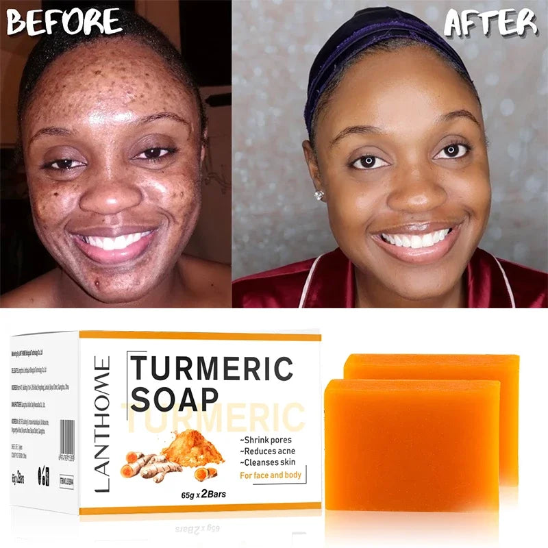 65g X2 Turmeric Soaps Natural Handmade Soap Clean