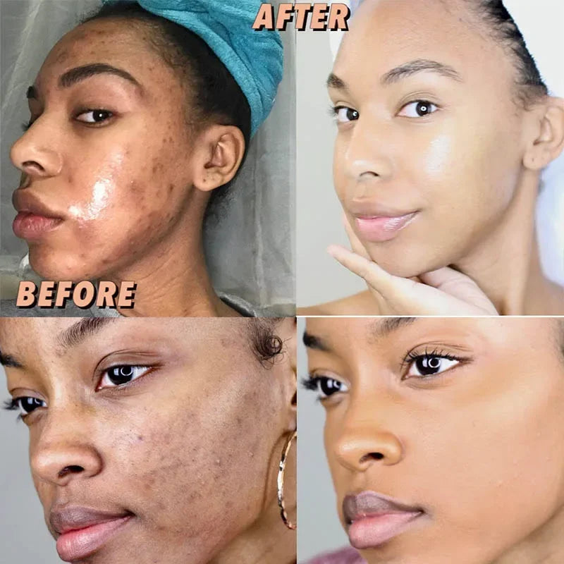 65g X2 Turmeric Soaps Natural Handmade Soap Clean