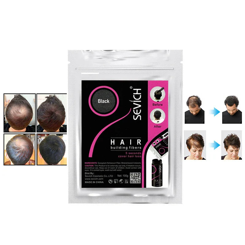 Sevich 1 kg Hair Building Fiber Hair Loss