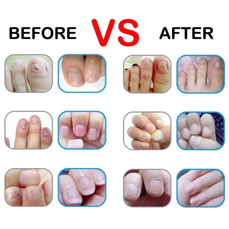 15 Smells Nail Nutrition Oil Pen Nail Treatment