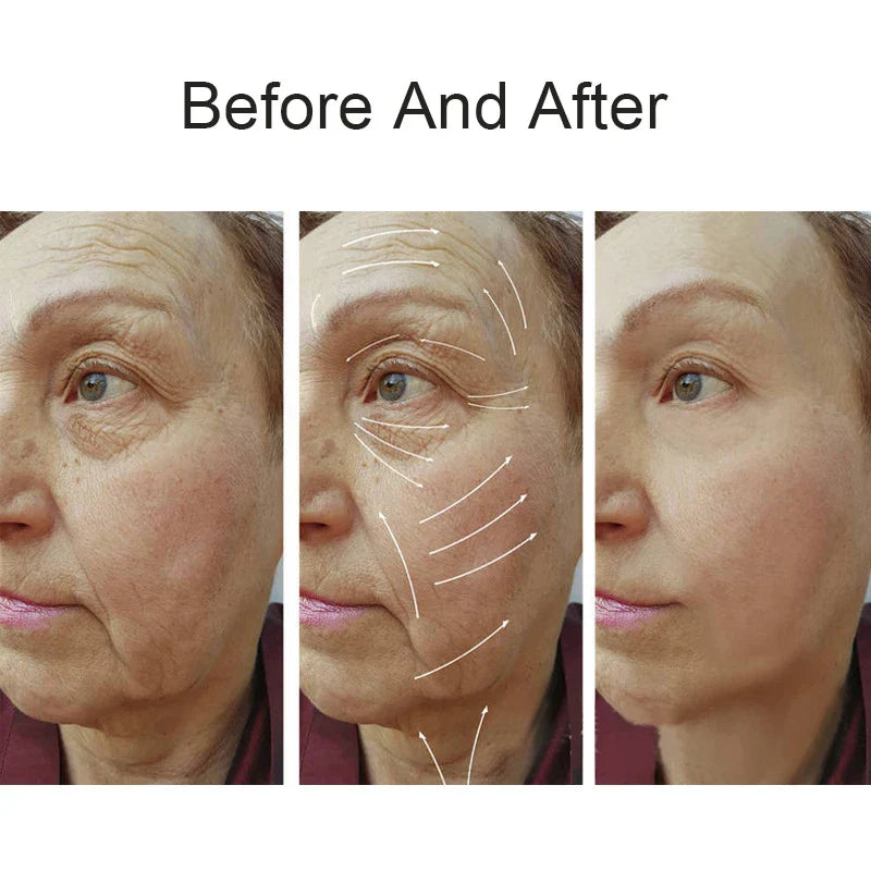 NEW Radio Frequency Machine RF Facial Beauty Device