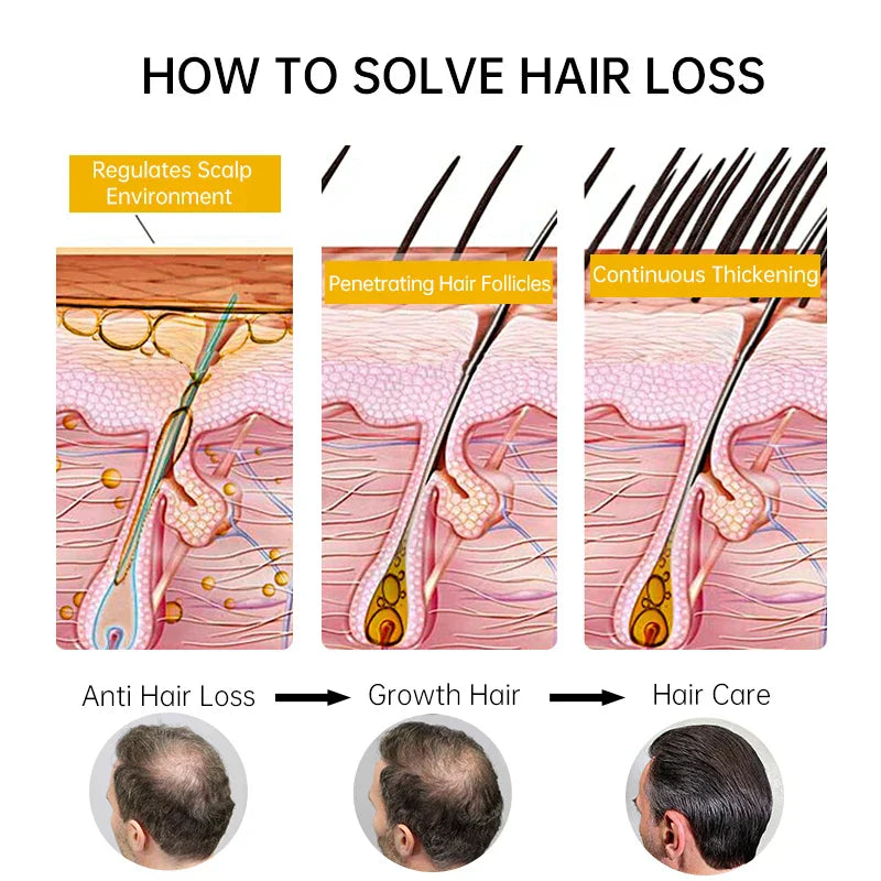 Fast Hair Growth for Men Women Ginger Grow