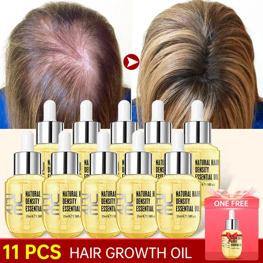 PURC 10PCS Hair Growth for Men Women Products