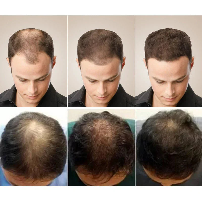 Ginger Hair Growth Soap Anti Hair Loss Fast