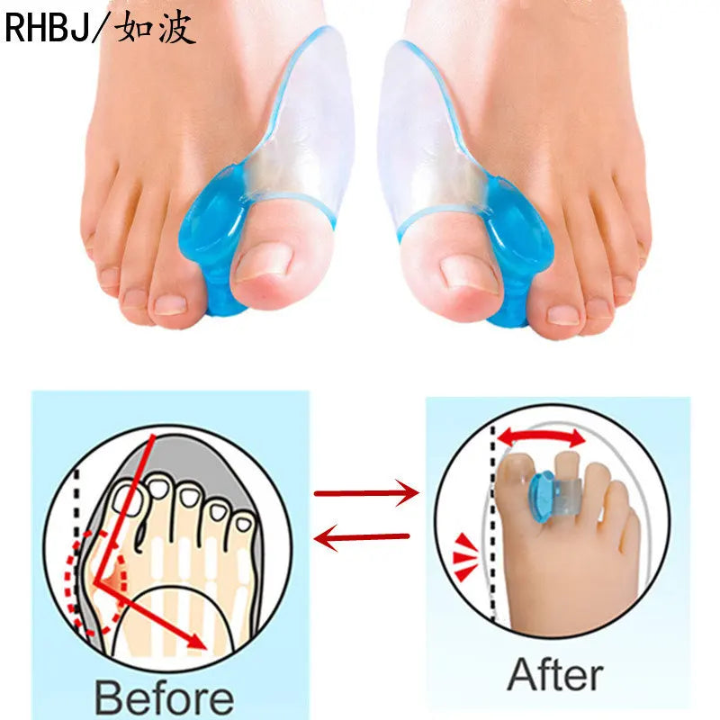 2Pcs Silicone Gel Thumb Corrector Bunion Foot Toe