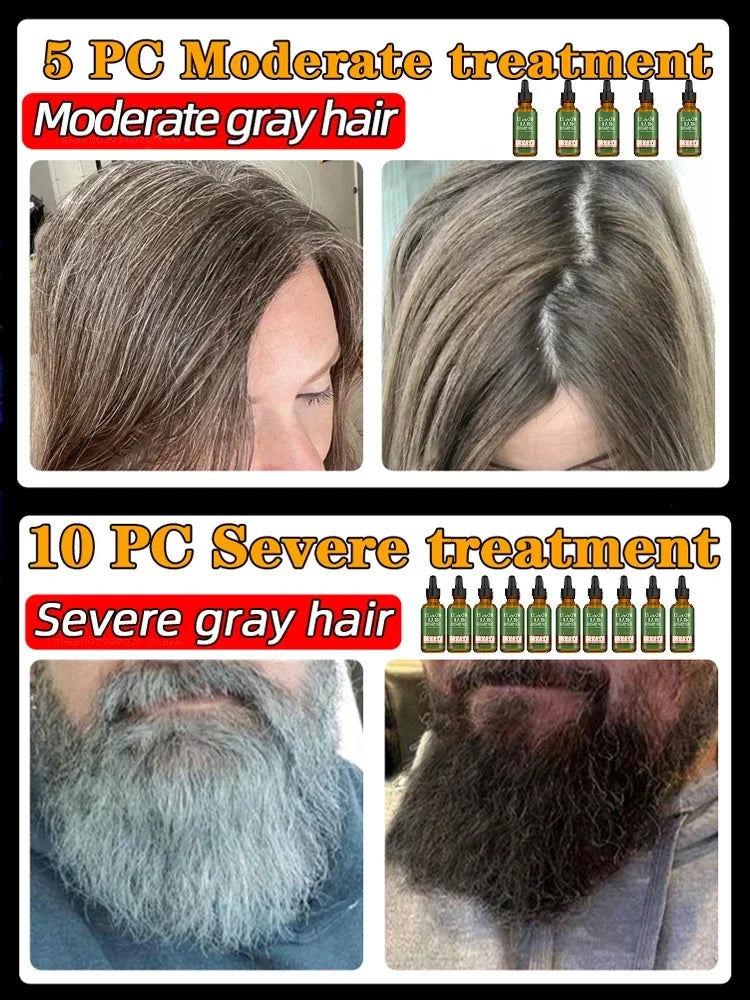 Gray Hair Treatment Serum White to Black Natural