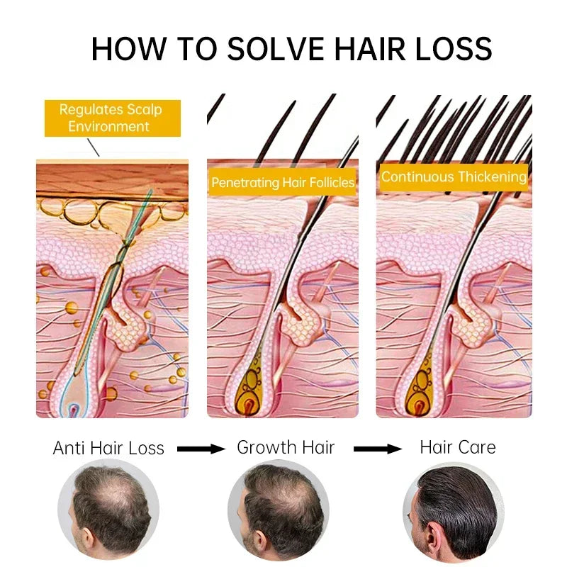 PURC Fast Hair Growth for Men Women Ginger