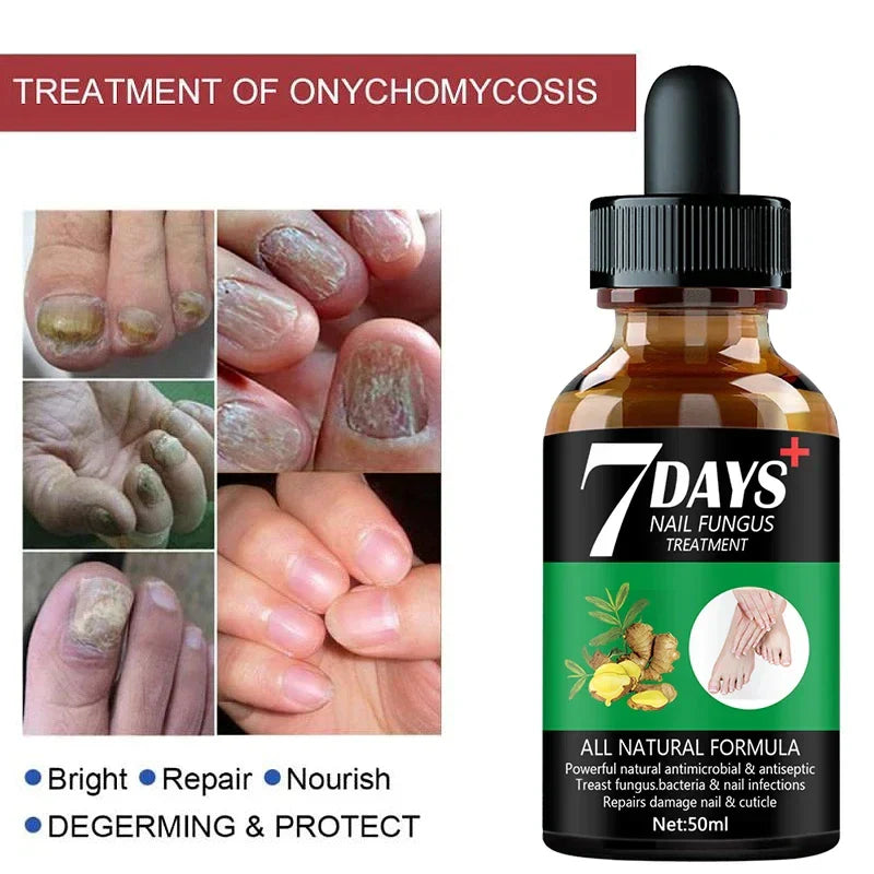 7DAYS Repair Nail Fungus Treatments Essence Foot Care