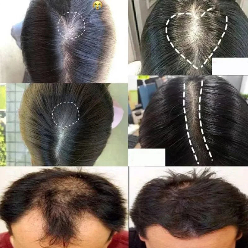 Ginger Hair Growth Spray Promote Fast Thicker Longer
