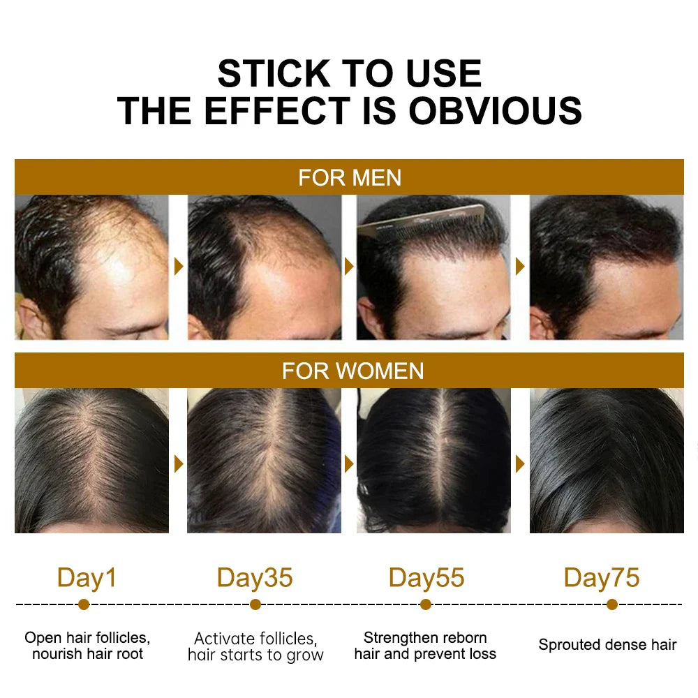 PURC Hair Growth Products for Men Women Ginger