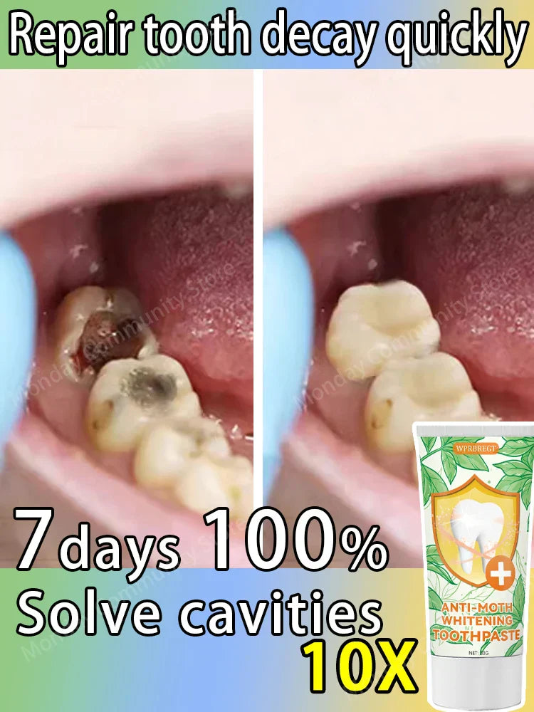 Best-selling, scientific fluoride repairs cavities, removes cavities, cleans