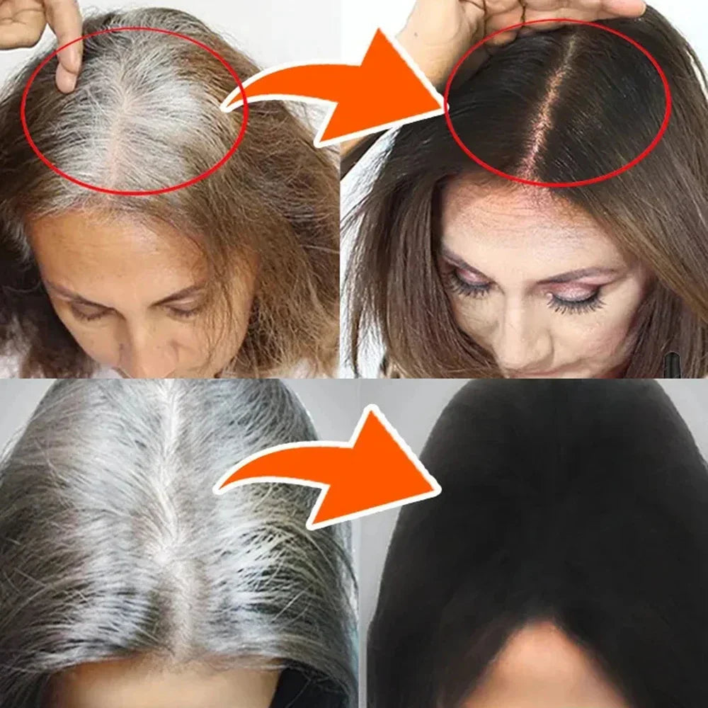Gray White Hair Treatment Serum Oil White To