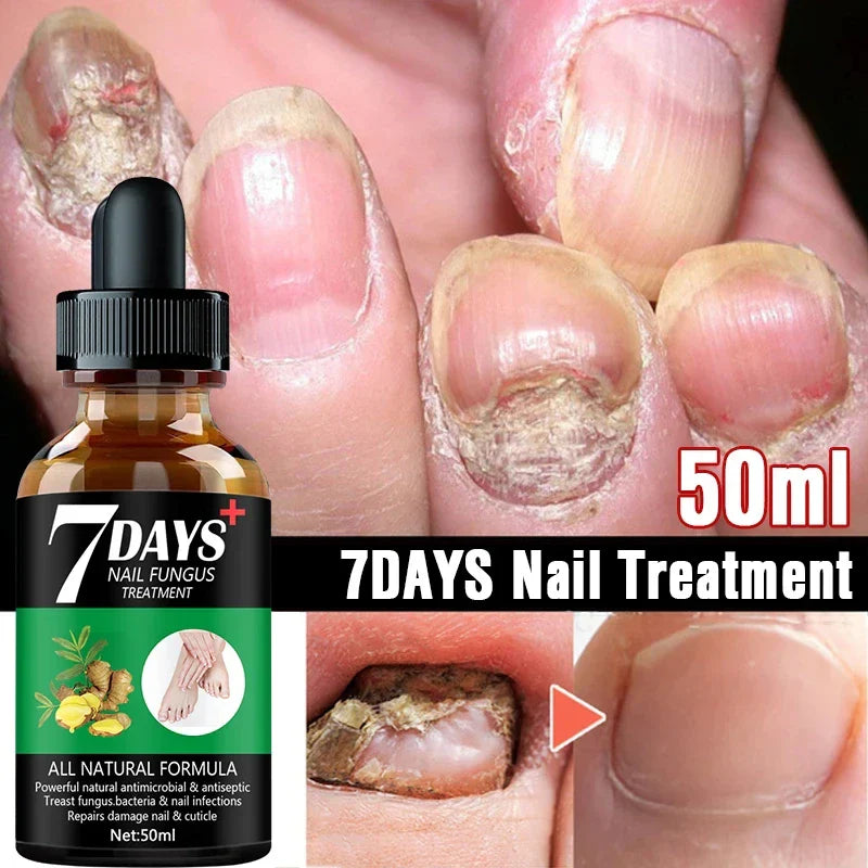 7DAYS Repair Nail Fungus Treatments Essence Foot Care