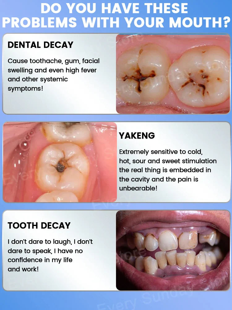 Best-selling, scientific fluoride repairs cavities, removes cavities, cleans