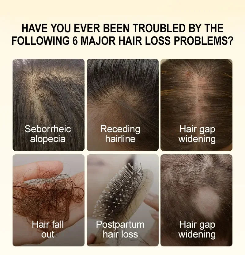 PURC Fast Hair Growth for Men Women Ginger