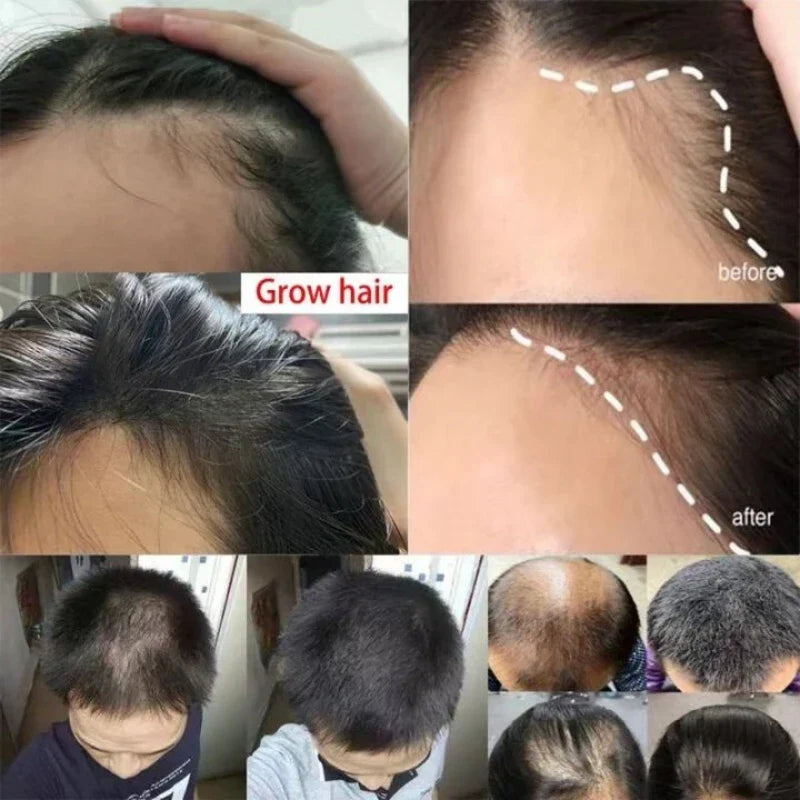 Ginger Hair Growth Spray Promote Fast Thicker Longer