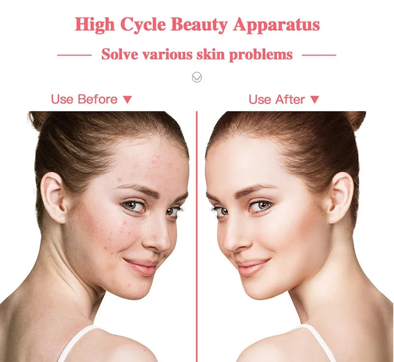 Four-tube electrode skin care rod portable high-frequency facial