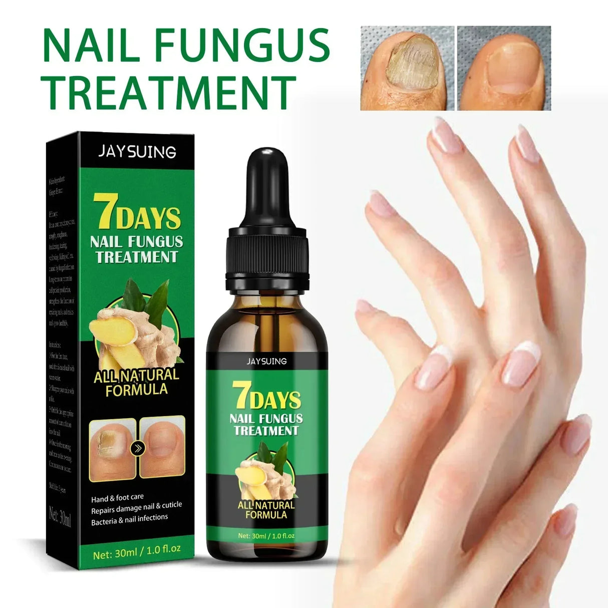 7DAYS Repair Nail Fungus Treatments Essence Foot Care