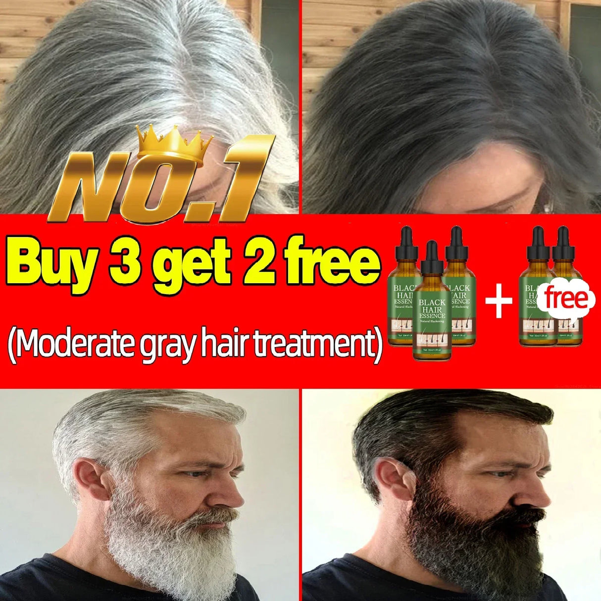 Gray Hair Treatment Serum White to Black Natural