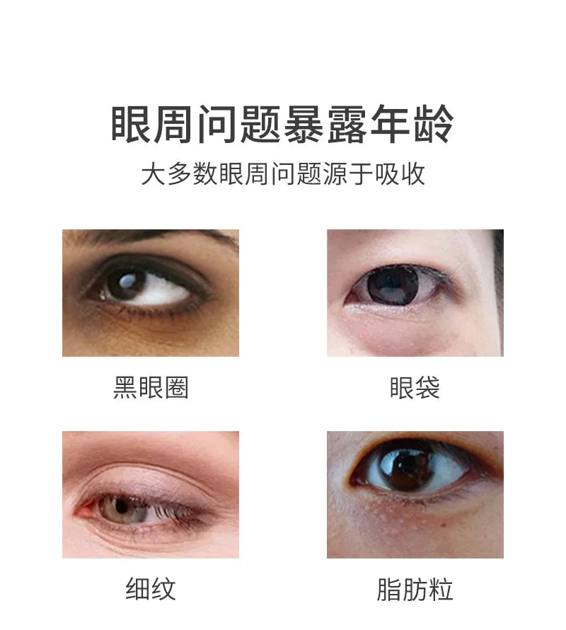 EMS Eye Beauty Instrument Microcurrent Red Light Rotatable