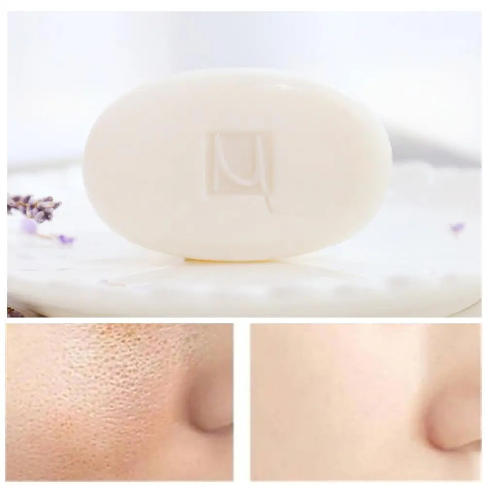 3X MANTING Mites Acarus Acari Removing Body Face