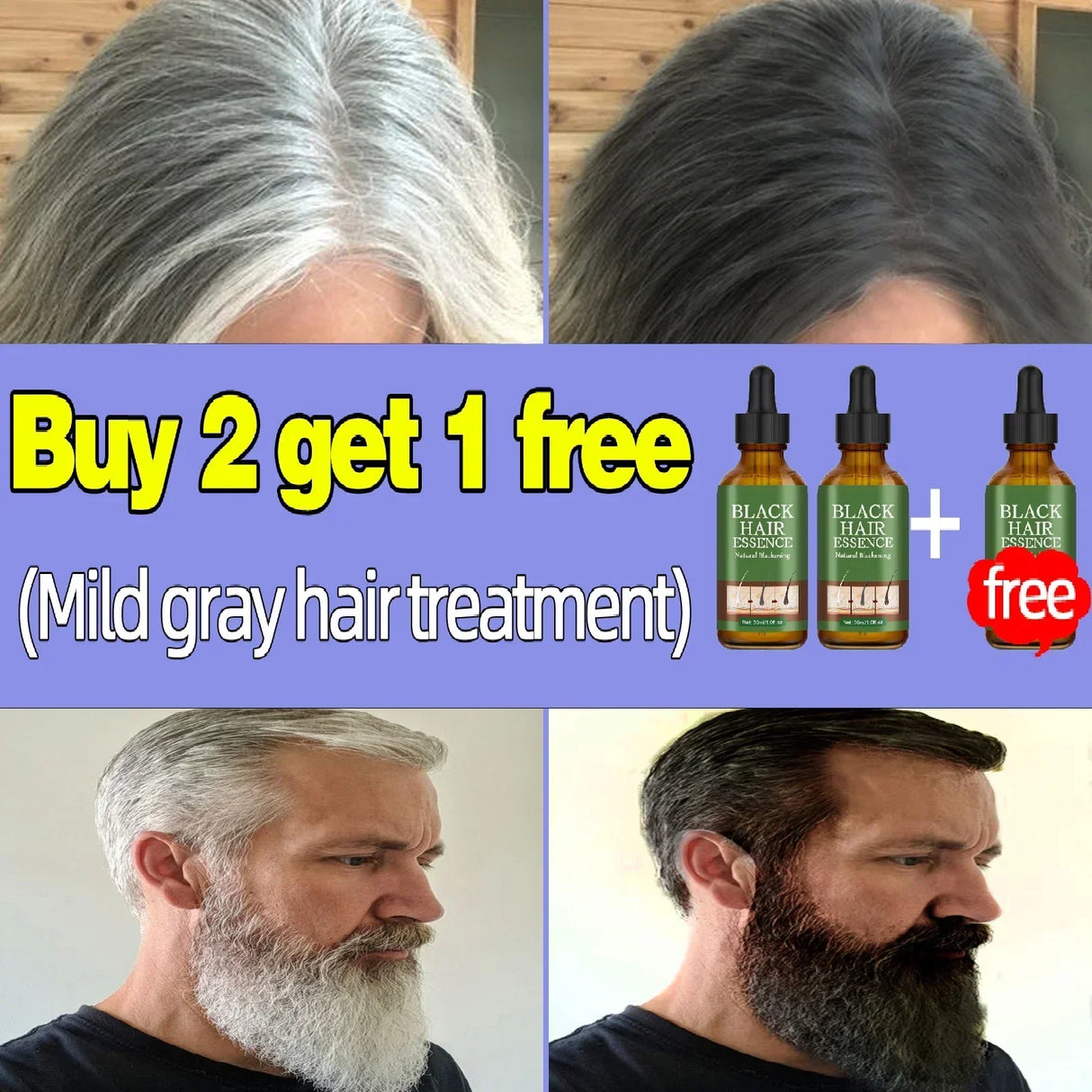 Gray Hair Treatment Serum White to Black Natural