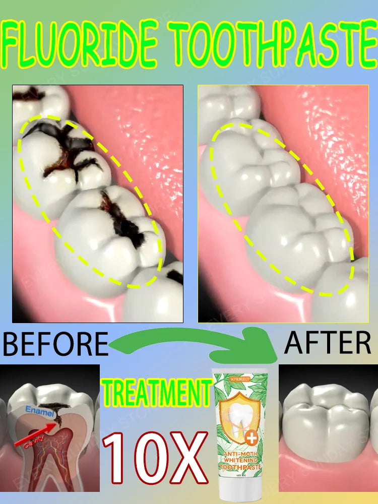 Best-selling, scientific fluoride repairs cavities, removes cavities, cleans