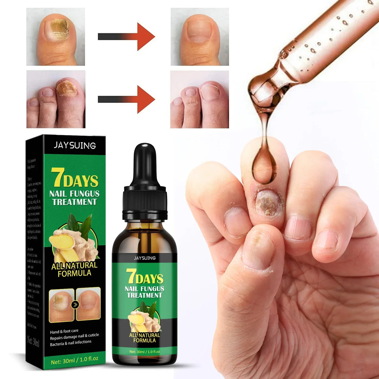 7DAYS Repair Nail Fungus Treatments Essence Foot Care