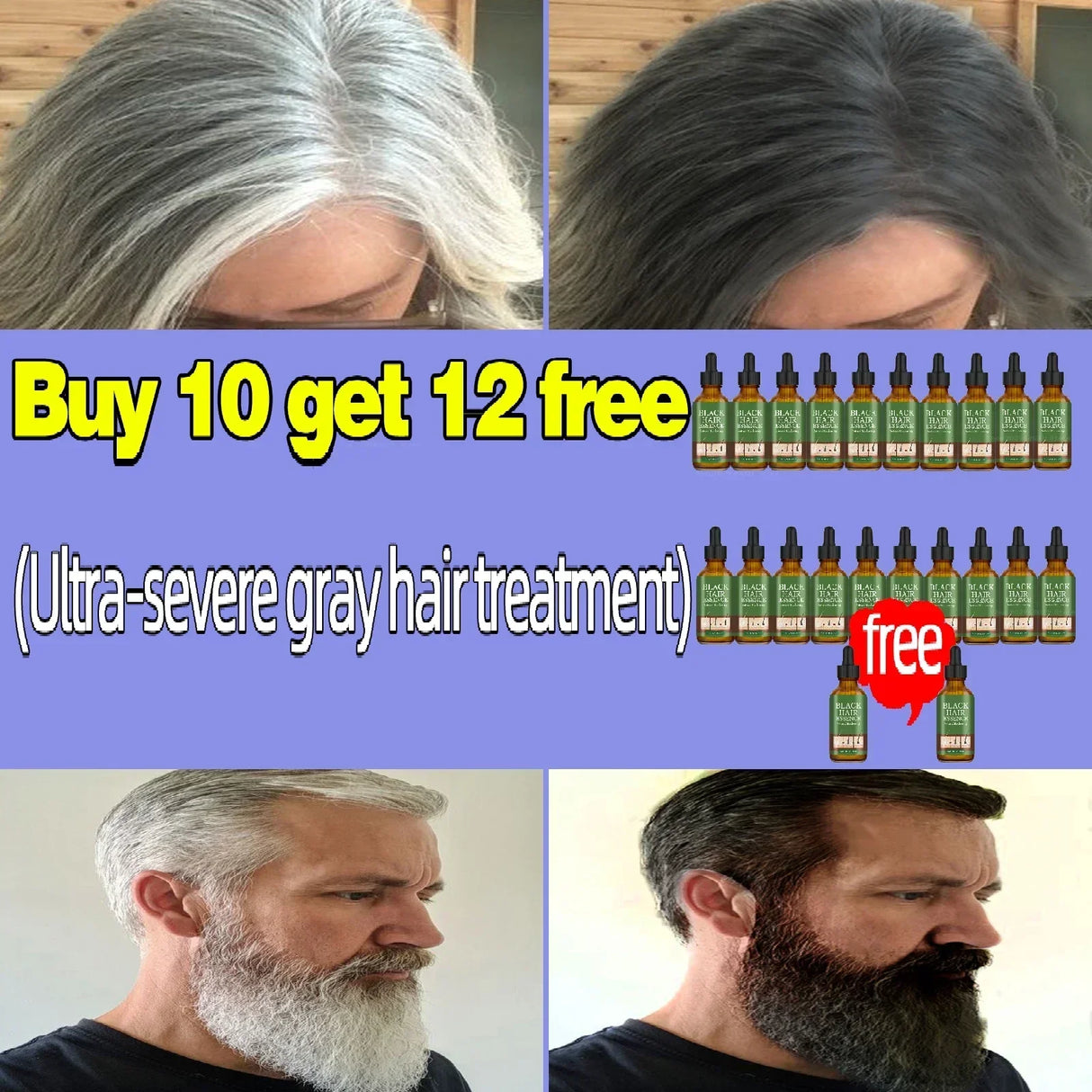 Gray Hair Treatment Serum White to Black Natural