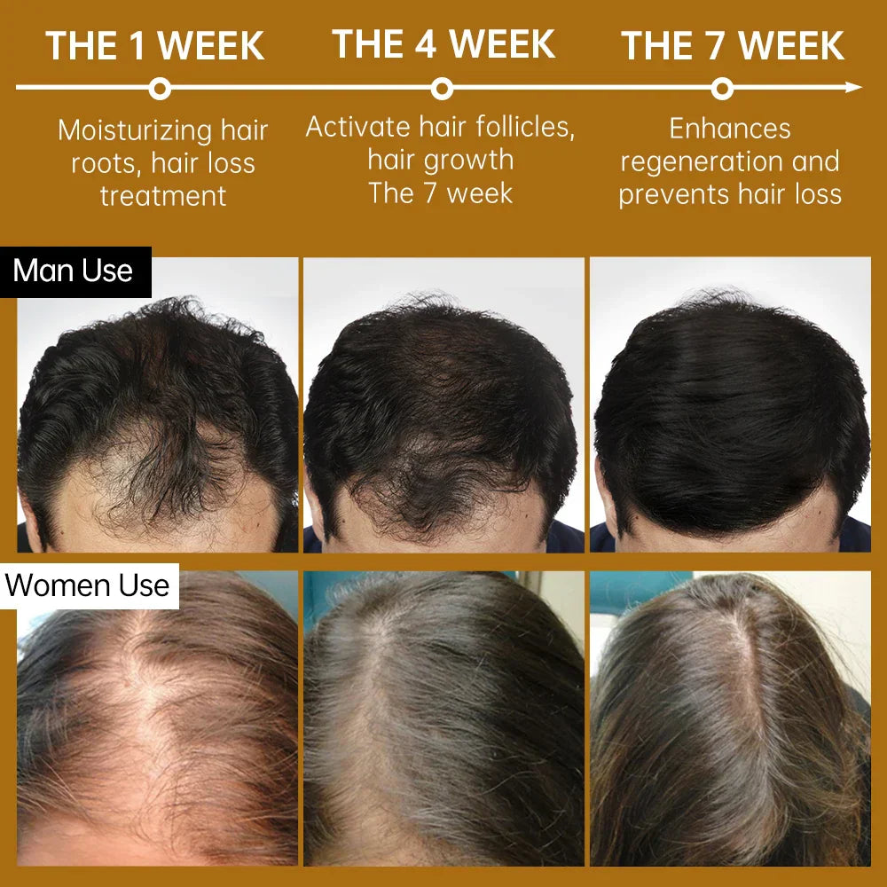PURC Hair Growth Oil for Men Women Anti
