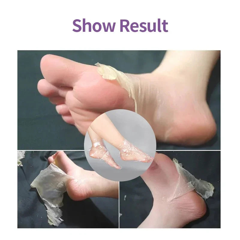 Foot Mask Exfoliating Anti Drying Cracking Heel Peeling