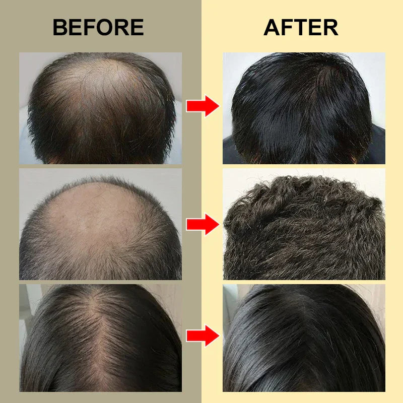 PURC 10PCS Hair Growth for Men Women Products