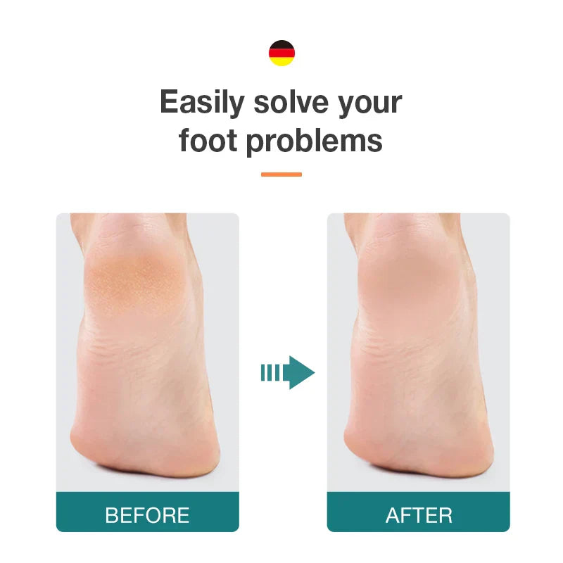 MR.GREEN Foot File Double Sided Callus Remover For