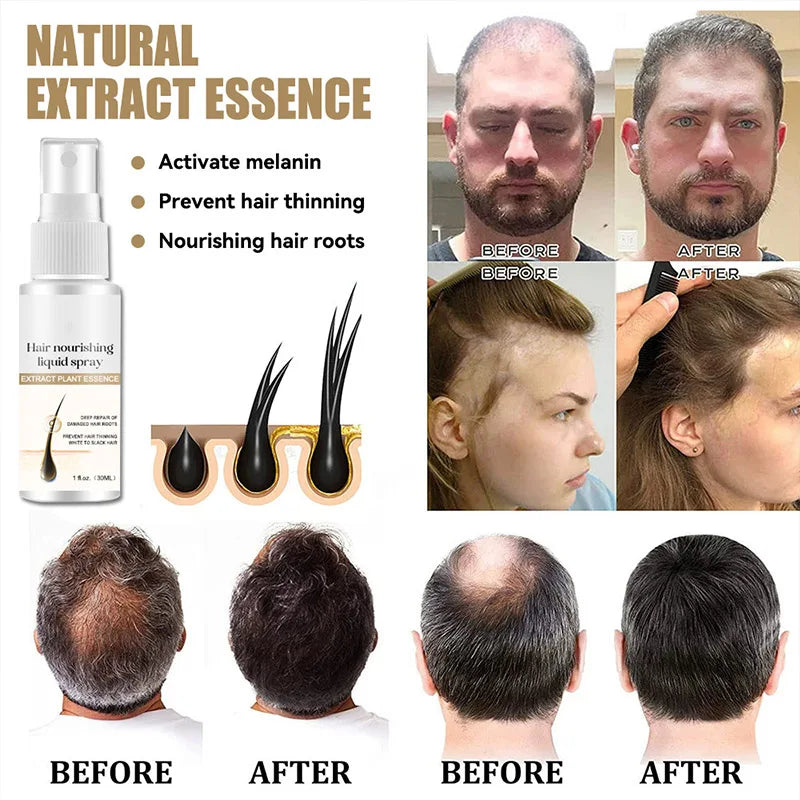 Ginger Hair Growth Spray Promote Fast Thicker Longer