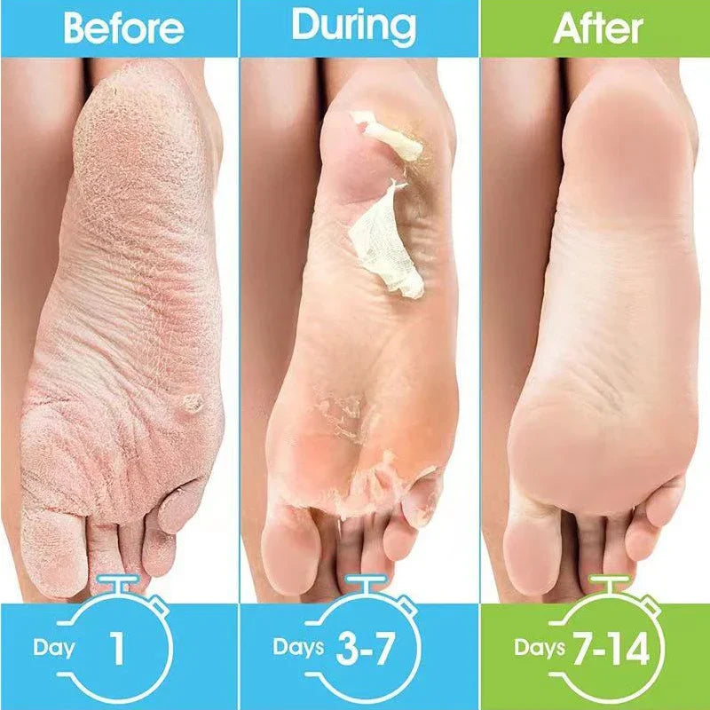 1 Pag = 1 Pair Honey Foot Mask