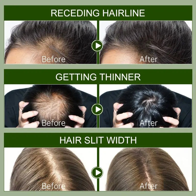 PURC Rosemary Oil Hair Growth Products for Men