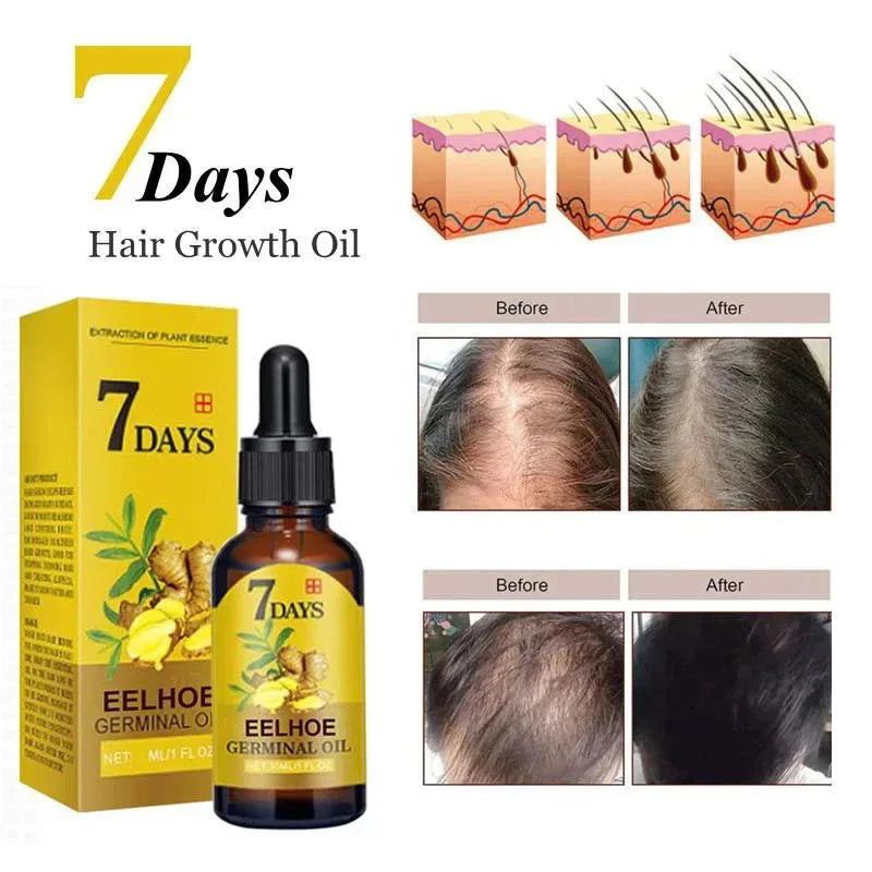 5pcs 7 Days Fast Ginger Hair Growth Serum