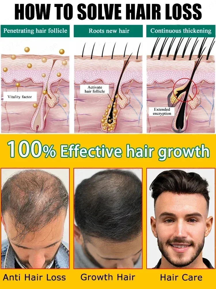 Rapid hair growth essential oil, repair baldness