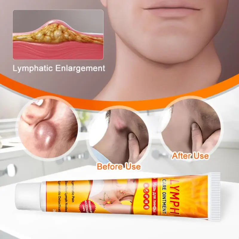 1/3/5Pcs Lymphatic Detox Cream Lymph Ointment Neck Anti-Swelling