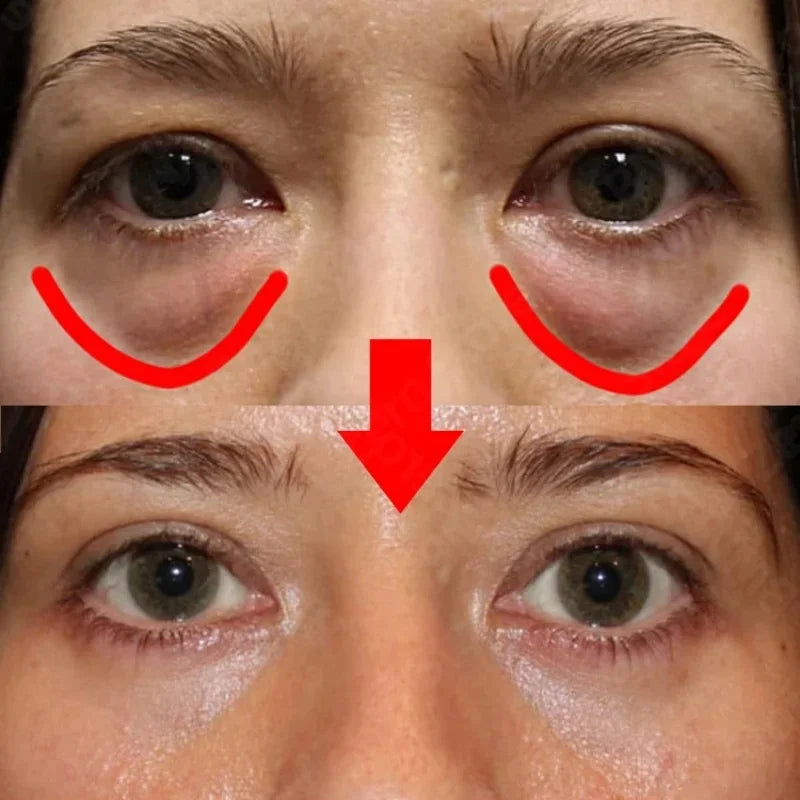 Peptide Anti-Wrinkle Eye Cream 7 Days Remove Puffiness