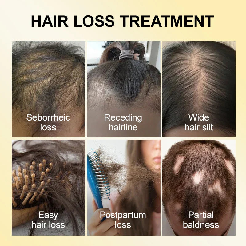 PURC 10PCS Hair Growth for Men Women Products
