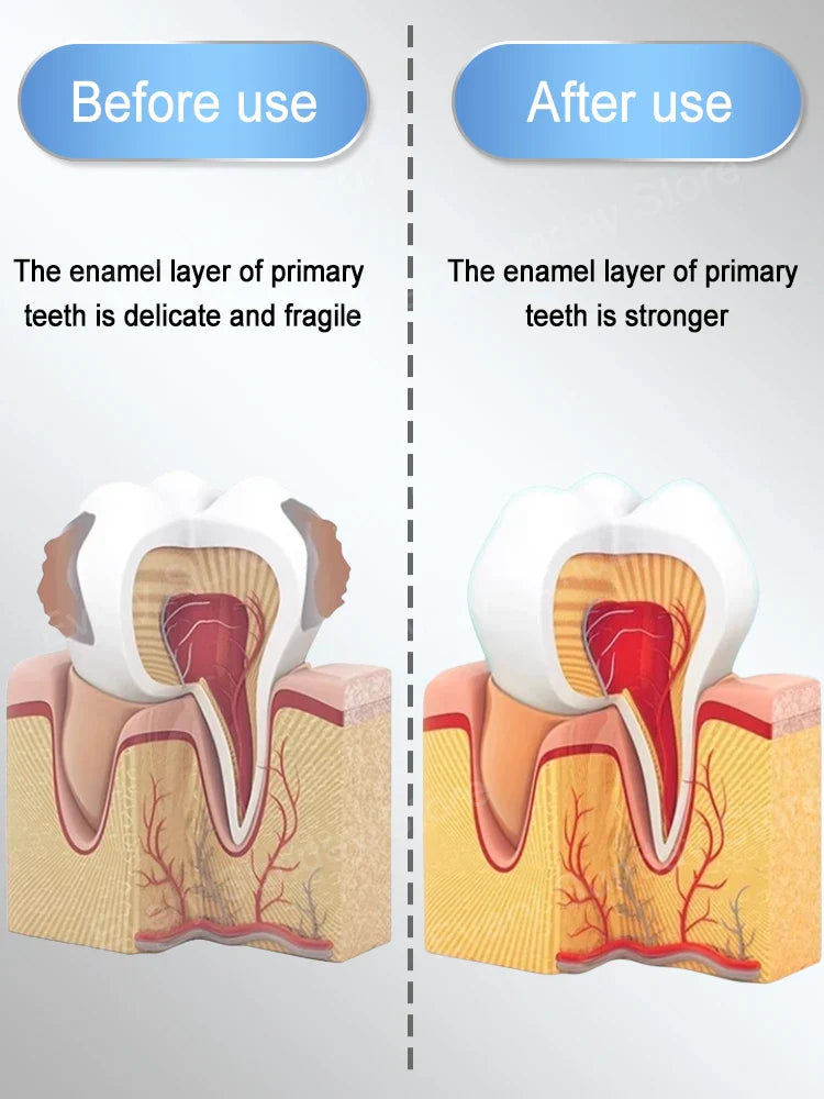 Best-selling, scientific fluoride repairs cavities, removes cavities, cleans
