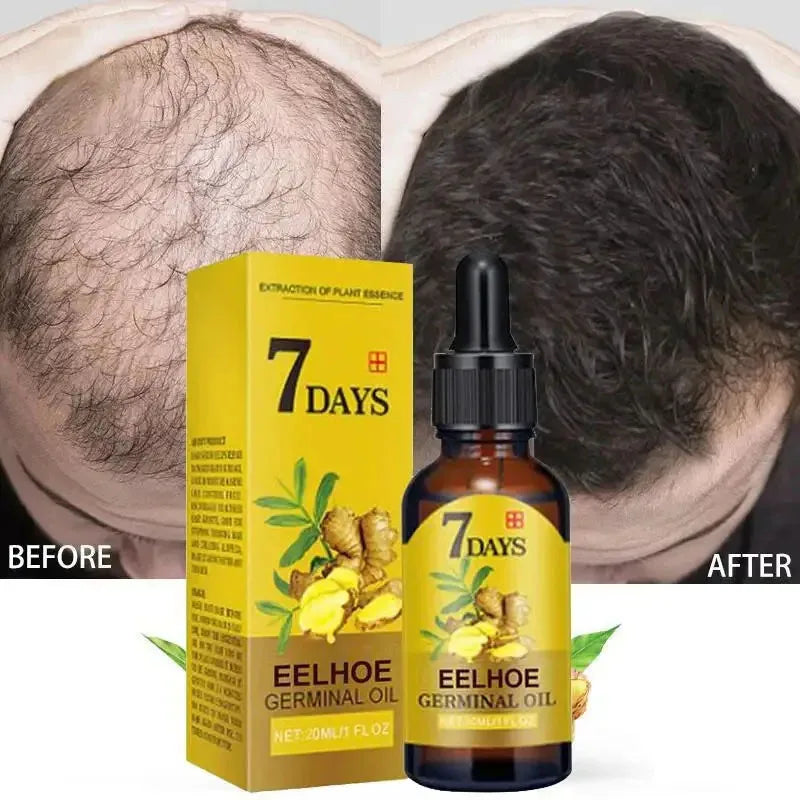 7 Days Fast Ginger Hair Growth Serum Anti-loss