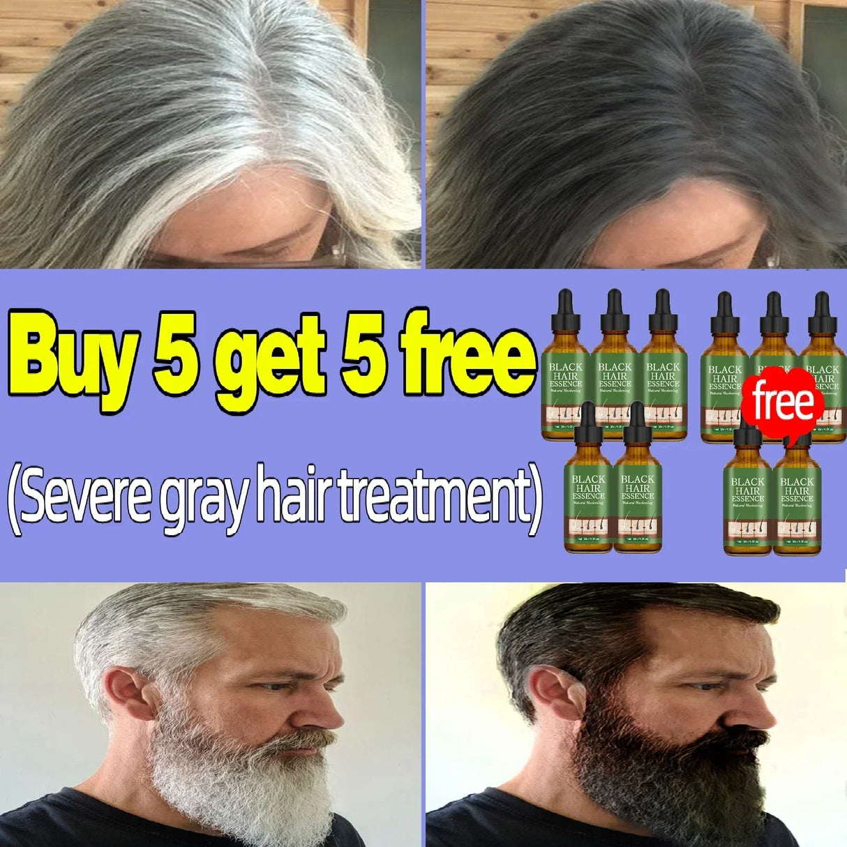 Gray Hair Treatment Serum White to Black Natural