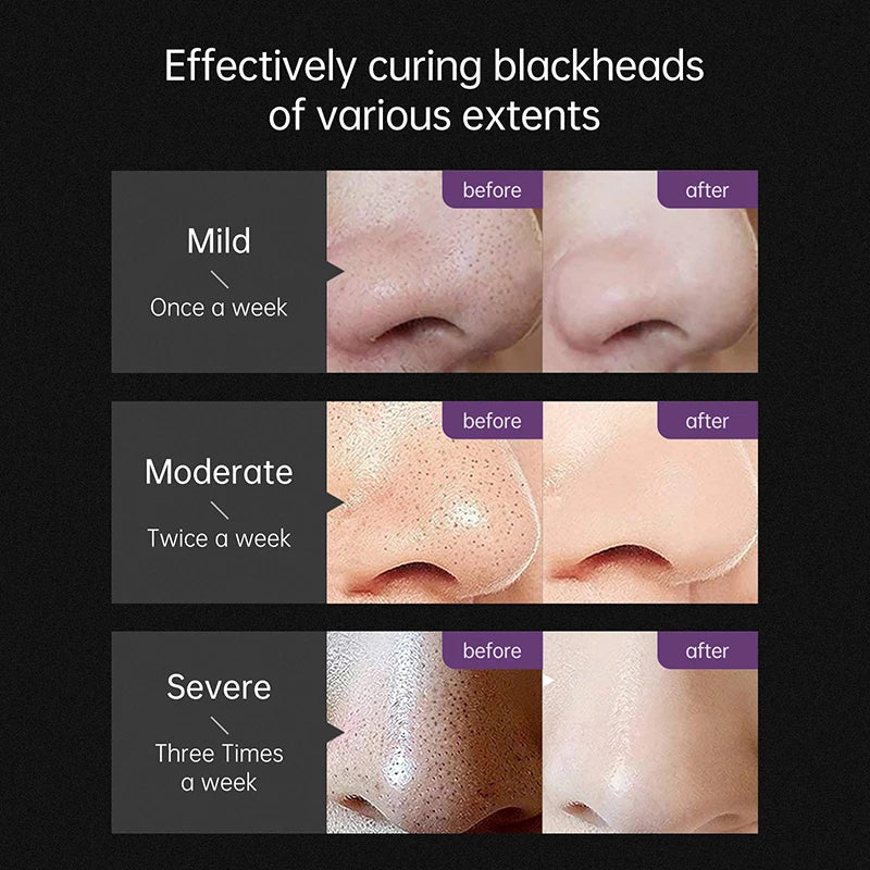 AUQUEST Blackhead Remover Black Dots Facial Masks NoseBamboo